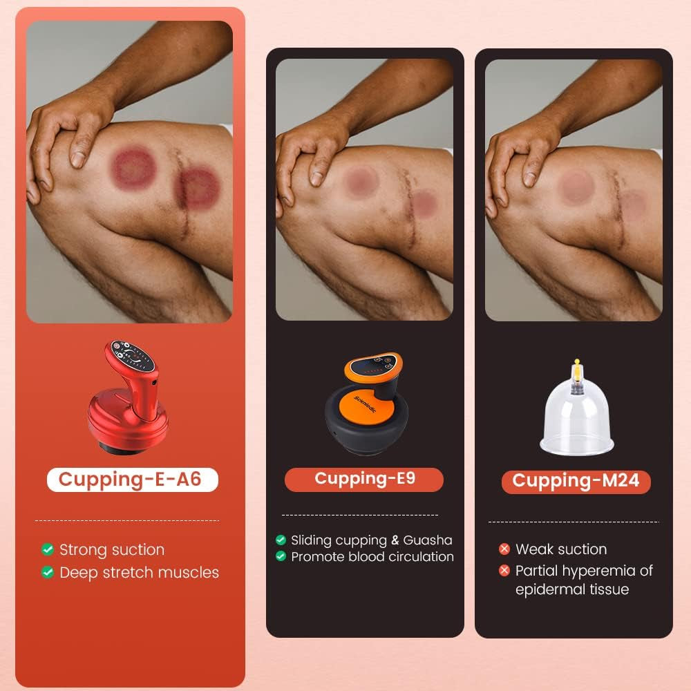 Scienlodic 3 in 1 Electric Cupping Therapy Machine